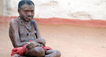 Conozca al famoso ‘hombre serpiente’