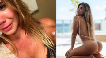 Hermosa modelo fue atacada por su ex pareja