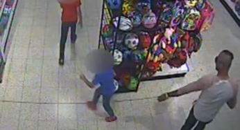 ¡Está loco! Le echó ácido a su hijo para quedarse con la custodia