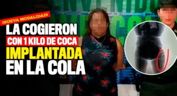 Cogieron a una mujer con 1 kilo de cocaína implantada en la cola