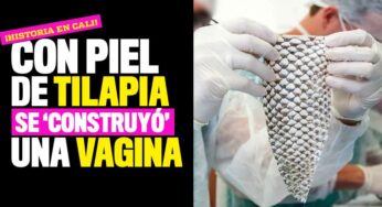 En Cali hicieron la primera construcción vaginal en el mundo con piel de tilapia