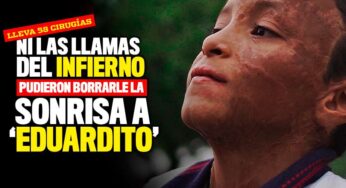 Ni las llamas del infierno pudieron borrarle la sonrisa a 'Eduardito'