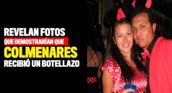 Revelan fotos que demostrarían que Colmenares recibió un botellazo