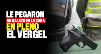 Le pegaron un tiro en la cara estando en el barrio El Vergel