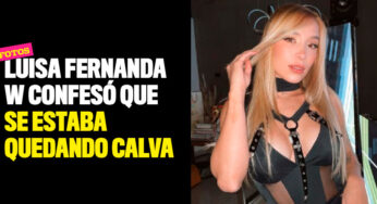 Luisa Fernanda W confesó que se estaba quedando calva