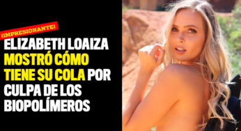 Elizabeth Loaiza mostró cómo tiene su cola por culpa de los biopolímeros