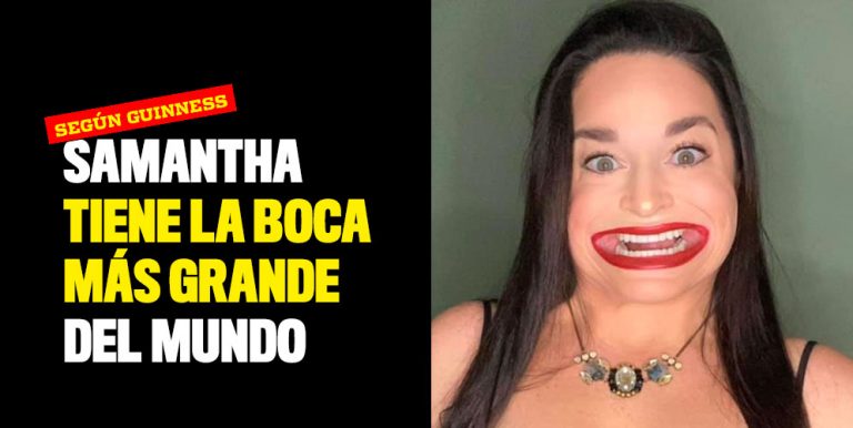 ¡increíble Samantha Tiene La Boca Más Grande Del Mundo 9663