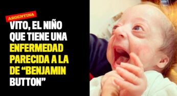 Vito, el niño que tiene una enfermedad parecida a la de "Benjamin Button"