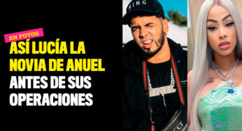 Así lucía la novia de Anuel antes de sus operaciones