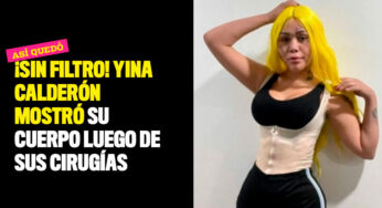 ¡Sin filtro! Yina Calderón mostró su cuerpo luego de sus cirugías