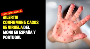 ¡Alerta! Confirman cinco casos de viruela del mono en España y Portugal