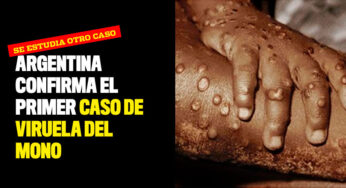 Argentina confirma el primer caso de viruela del mono