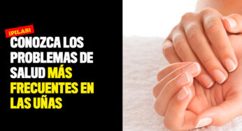 Conozca los problemas de salud más frecuentes en las uñas