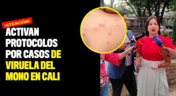 Activan protocolos por casos de viruela del mono en Cali