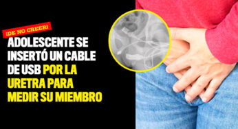 Adolescente se insertó un cable de USB por la uretra para medir su miembro