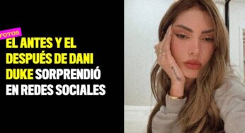 Fotos: el antes y el después de Dani Duke sorprendió en redes sociales