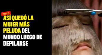 Así quedó la mujer más peluda del mundo luego de depilarse