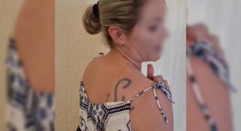 Mujer denuncia que su pareja le 'tatúo' sus iniciales con hierro para ganado