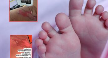 Madre dejó a su bebé en una guardería y cuando regresó tenía graves quemaduras 