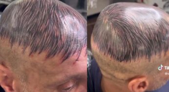 VIDEO: Cansado de su calvicie, decidió tatuarse un peluquín en la cabeza