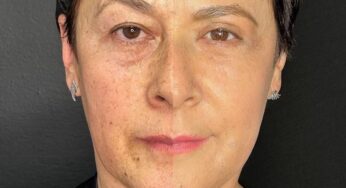 Las fotos de la sorprendente transformación de Alina Lozano