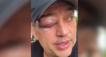 Golpearon al hijo de Rodolfo Hernández