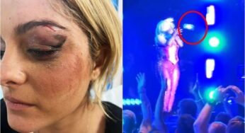 Video: cantante fue herida por fan que le lanzó un teléfono directo a la cara