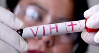 Ministerio de Salud desmiente brote de VIH en Colombia y llama a la prevención responsable